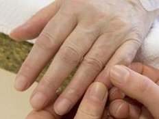 Richtiges Essen hilft bei rheumatoider Arthritis