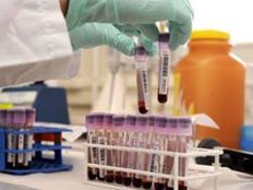 Neuer Dopingtest für Wachstumshormon vor der Einführung Neuer Dopingtest für Wachstumshormon vor der Einführung