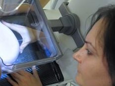 Studie: Mammografie-Screening erfolgreich im Kampf gegen Brustkrebs